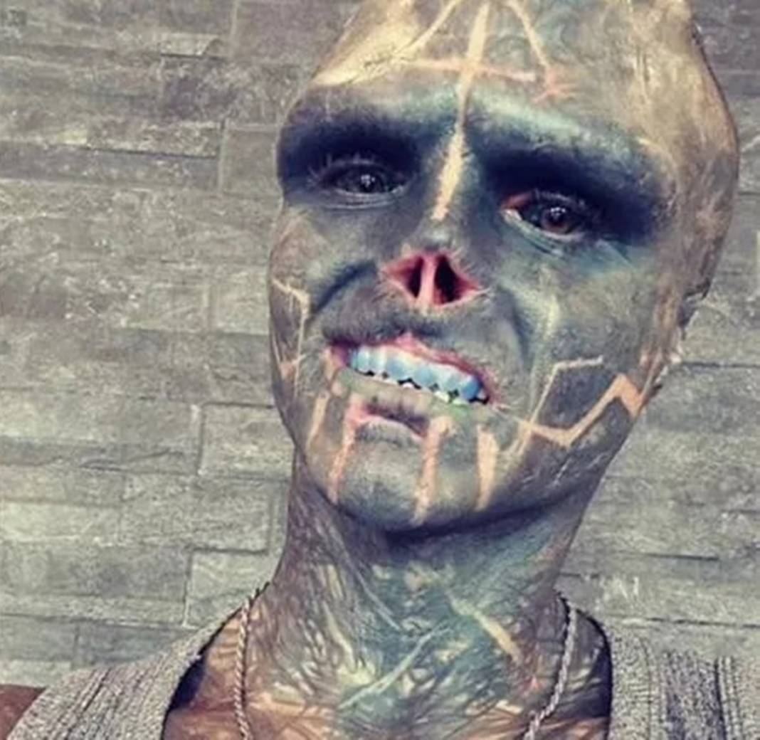 Siyah bir uzaylıya benzemek için kulaklarını, burnunu ve üst dudağını aldırdı! Bu fotoğrafları çocuklar görmesin! 6